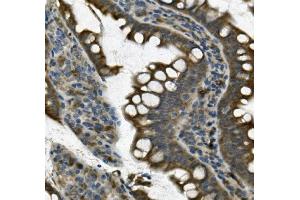 IHC analysis of UNG using anti UNG antibody (ABIN7602695). (UNG Antikörper  (AA 96-313))