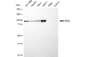 Western blotting analysis using TPX2 antibody (ABIN7800579). (Rekombinanter TPX2 Antikörper)