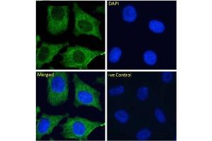 Immunofluorescence (IF) image for anti-C-Type Lectin Domain Family 4, Member M (CLEC4M) antibody (ABIN5668174)