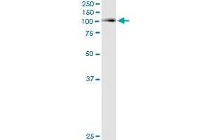ACO1 (Human) IP-WB Antibody Pair