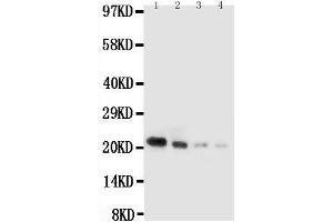 Anti-mouse IL18 antibody, Western blotting Lane 1: Recombinant Mouse IL18 Protein 10ng Lane 2: Recombinant Mouse IL18 Protein 5ng Lane 3: Recombinant Mouse IL18 Protein 2 (IL-18 Antikörper  (AA 36-192))