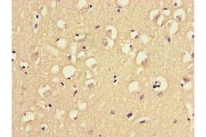 Immunohistochemistry of paraffin-embedded human brain tissue using ABIN7159790 at dilution of 1:100