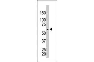 The PKM2 polyclonal antibody  is used in Western blot to detect PKM2 in HeLa cell lysate . (PKM2 Antikörper  (AA 483-513))