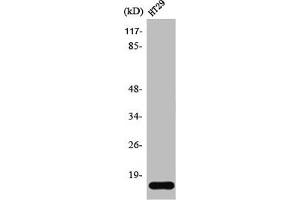Western Blot analysis of HT29 cells using Synuclein-γ Polyclonal Antibody (SNCG Antikörper  (C-Term))