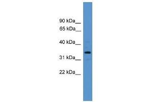 Western Blot showing ARG2 antibody used at a concentration of 1-2 ug/ml to detect its target protein. (ARG2 Antikörper  (Arg2, N-Term))