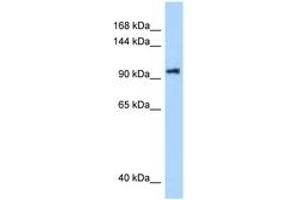 Image no. 1 for anti-DEAH (Asp-Glu-Ala-His) Box Polypeptide 16 (DHX16) (AA 171-220) antibody (ABIN6748026) (DHX16 Antikörper  (AA 171-220))