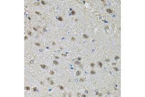 Immunohistochemistry of paraffin-embedded mouse brain using PPID Antibody (ABIN5974177) at dilution of 1/100 (40x lens). (PPID Antikörper)