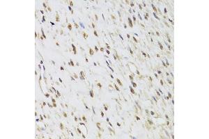 Immunohistochemistry of paraffin-embedded human leiomyoma of uterus using SEPHS1 Antibody. (SEPHS1 Antikörper)