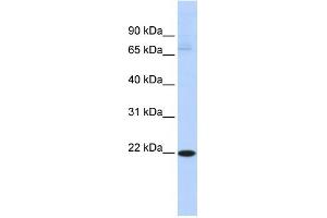 WB Suggested Anti-RBPMS2 Antibody Titration:  0. (RBPMS2 Antikörper  (Middle Region))
