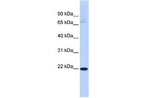 WB Suggested Anti-RBPMS2 Antibody Titration:  0.