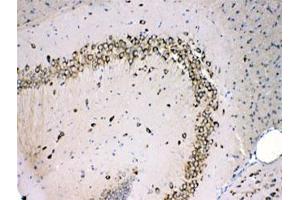 IHC testing of FFPE mouse brain with MPS1 antibody at 1ug/ml. (RPS27 Antikörper)