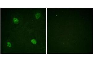 Immunofluorescence staining of methanol-fixed HeLa cells using hnRPD (Phospho-Ser83) Antibody. (HNRNPD/AUF1 Antikörper  (pSer83))