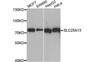 Western blot analysis of extracts of various cell lines, using SLC25A13 antibody (ABIN6292454) at 1:1000 dilution. (slc25a13 Antikörper)