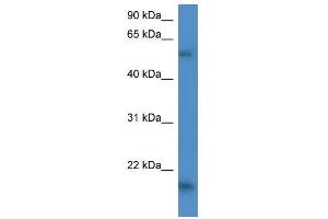 GPT2 antibody used at 1 ug/ml to detect target protein. (GPT2 Antikörper)