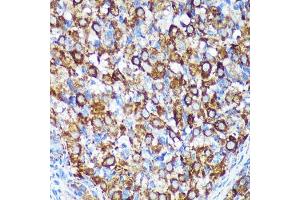 Immunohistochemistry of paraffin-embedded Rat ovary using [KO Validated] CHCHD2 Rabbit pAb (ABIN7266448) at dilution of 1:100 (40x lens). (CHCHD2 Antikörper  (AA 75-145))