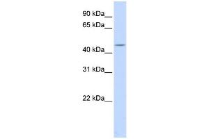WB Suggested Anti-HSFY1 Antibody Titration:  0. (HSFY1 Antikörper  (Middle Region))