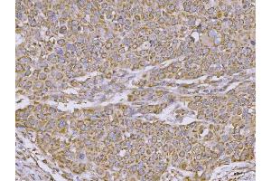 IHC analysis of CLASP1 using anti-CLASP1 antibody (ABIN7599144). (CLASP1 Antikörper  (AA 1-243))