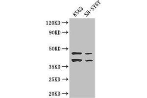 Western Blot Positive WB detected in: K562 whole cell lysate, SH-SY5Y whole cell lysate All lanes: AIM2 antibody at 2. (AIM2 Antikörper  (AA 81-326))