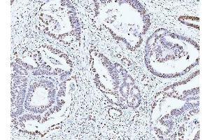IHC analysis of MCM6 using anti-MCM6 antibody (ABIN7600037). (MCM6 Antikörper  (AA 14-821))