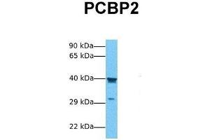 Host:  Rabbit  Target Name:  PCBP2  Sample Tissue:  Human Jurkat  Antibody Dilution:  1.