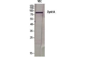 Western Blot (WB) analysis of specific cells using Dyrk1A Polyclonal Antibody.