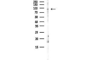 anti-Promyelocytic Leukemia (PML) (N-Term) antibody