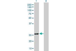 Western Blot analysis of EXOSC5 expression in transfected 293T cell line by EXOSC5 MaxPab polyclonal antibody. (EXOSC5 Antikörper  (AA 1-235))