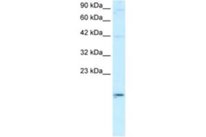 Western Blotting (WB) image for anti-Apolipoprotein B mRNA Editing Enzyme, Catalytic Polypeptide-Like 3G (APOBEC3G) antibody (ABIN2460746) (APOBEC3G Antikörper)