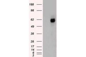 HEK293T cells were transfected with the pCMV6-ENTRY control (Left lane) or pCMV6-ENTRY CHEK2 (Right lane) cDNA for 48 hrs and lysed. (CHEK2 Antikörper)
