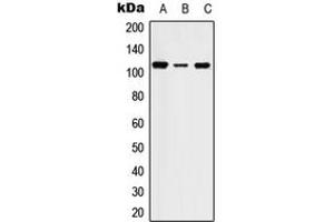 Western blot analysis of STK31 expression in HEK293T (A), SP2/0 (B), PC12 (C) whole cell lysates. (STK31 Antikörper  (Center))
