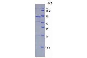 SDS-PAGE analysis of Human FGL1 Protein. (FGL1 Protein)