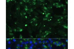 Immunofluorescence analysis of C6 cells using ENO1 Polyclonal Antibody at dilution of 1:100. (ENO1 Antikörper)