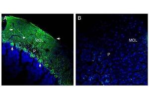 Expression of SLC38A1 in rat cerebellum. (SLC38A1 Antikörper  (Cytosolic))