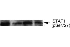 Western blot analysis of extract from thyroid cancer cell line Bph cells, using STAT1 (phospho-Ser727) antibody (E011163). (STAT1 Antikörper  (pSer727))