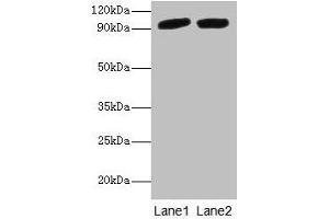 Western blot All lanes: POSTN antibody at 2 μg/mL Lane 1: Mouse liver tissue Lane 2: Hela whole cell lysate Secondary Goat polyclonal to rabbit IgG at 1/10000 dilution Predicted band size: 94, 88, 84, 91, 81 kDa Observed band size: 94 kDa (Periostin Antikörper  (AA 24-836))