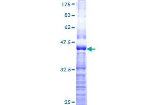 SEMA3A Protein (AA 672-770) (GST tag)