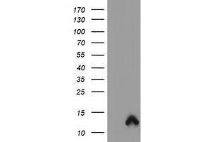 Image no. 1 for anti-S100 Calcium Binding Protein P (S100P) antibody (ABIN1500789) (S100P Antikörper)