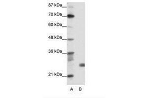 Image no. 1 for anti-Sin3A-Associated Protein, 30kDa (SAP30) (N-Term) antibody (ABIN202078) (SAP30 Antikörper  (N-Term))