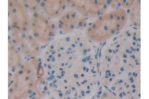 Detection of OPN in Rat Kidney Tissue using Polyclonal Antibody to Osteopontin (OPN) (Osteopontin Antikörper  (AA 17-317))