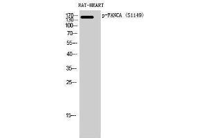 Western Blotting (WB) image for anti-Fanconi Anemia Group A Protein (FANCA) (pSer1149) antibody (ABIN3182820)