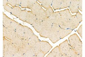 ABIN6256821 and ABIN6277223 at 1/100 staining Rat muscle tissue by IHC-P.