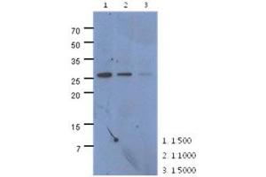 The extracts of HeLa (40ug) were resolved by SDS-PAGE, transferred to PVDF membrane and probed with anti-human CMBL antibody (1:500 ~ 1:5000). (CMBL Antikörper)