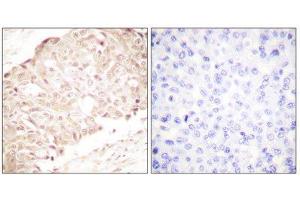 Immunohistochemistry (IHC) image for anti-SUMO1/sentrin Specific Peptidase 1 (SENP1) (N-Term) antibody (ABIN1848840) (SENP1 Antikörper  (N-Term))