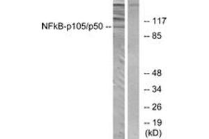 Western blot analysis of extracts from HeLa cells, using NF-kappaB p105/p50 (Ab-893) Antibody. (NFKB1 Antikörper  (AA 860-909))