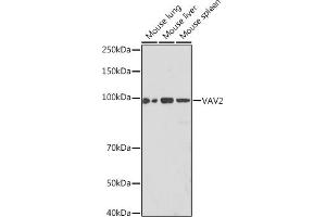 Western blot analysis of extracts of various cell lines, using V Rabbit mAb (ABIN7271304) at 1:1000 dilution. (VAV2 Antikörper)