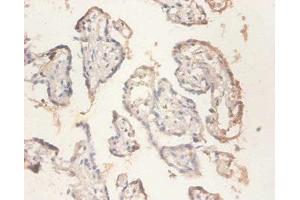Immunohistochemistry of paraffin-embedded human placenta tissue using ABIN7142480 at dilution of 1:100 (RPS11 Antikörper  (AA 2-158))