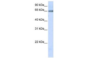 Western Blotting (WB) image for anti-DNA Cross-Link Repair 1C (DCLRE1C) antibody (ABIN2459466) (DCLRE1C Antikörper)