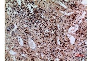 Immunohistochemical analysis of paraffin-embedded human-lung, antibody was diluted at 1:100.