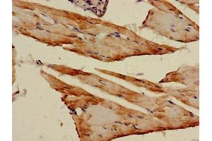 Immunohistochemistry of paraffin-embedded human skeletal muscle tissue using ABIN7143343 at dilution of 1:100 (Adenylate Kinase 1 Antikörper  (AA 1-194))