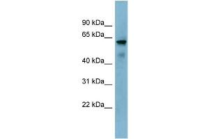 WB Suggested Anti-KIAA1627 Antibody Titration:  0. (KIAA1627 Antikörper  (N-Term))